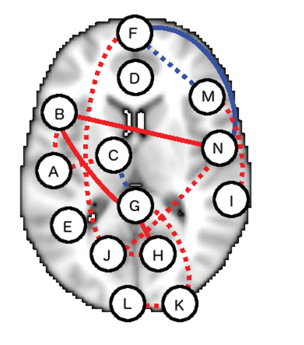 Neuroimaging Data