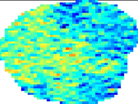 Radiomics